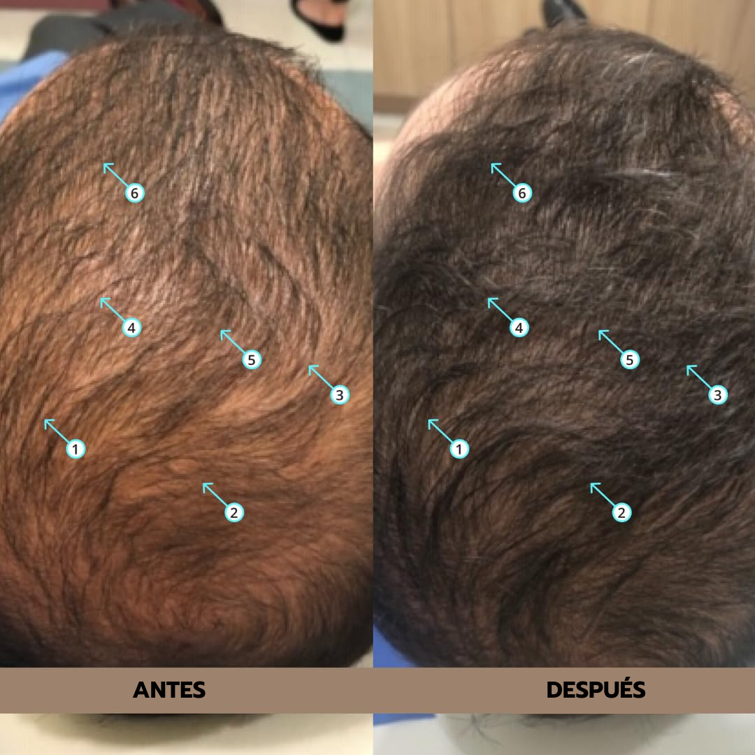 DS Labs Spectral Men's Hair Density Serum 60 mL: Sérum capilar masculino que reactiva los folículos y multiplica la densidad del cabello.